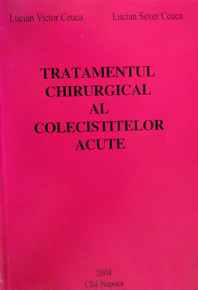 Tratamentul laparoscopic al colecistitelor acute